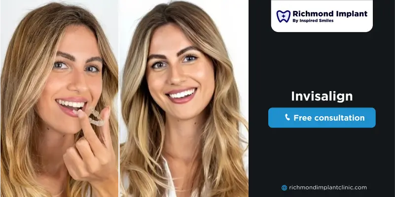 how does invisalign work